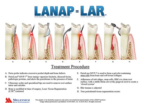 gum disease treatment near me|Laser Gum Surgery Costs, Procedure, Side Effects .